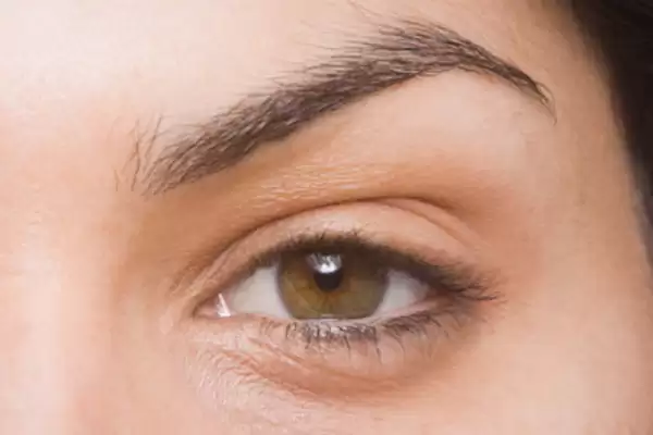 علامة واضحة في العين قد يظنها البعض بسيطة..تشير إلى الإصابة بسرطان العين