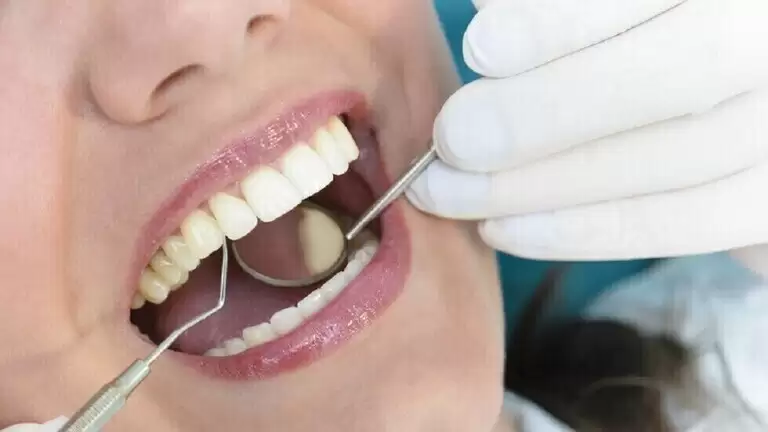  لتبييض اسنانك بدون طبيب .. اتبع هذه الطريقة لإزالة الجير منها وانت في منزلك !